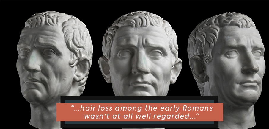 hair-loss-throughout-history-ancient-era