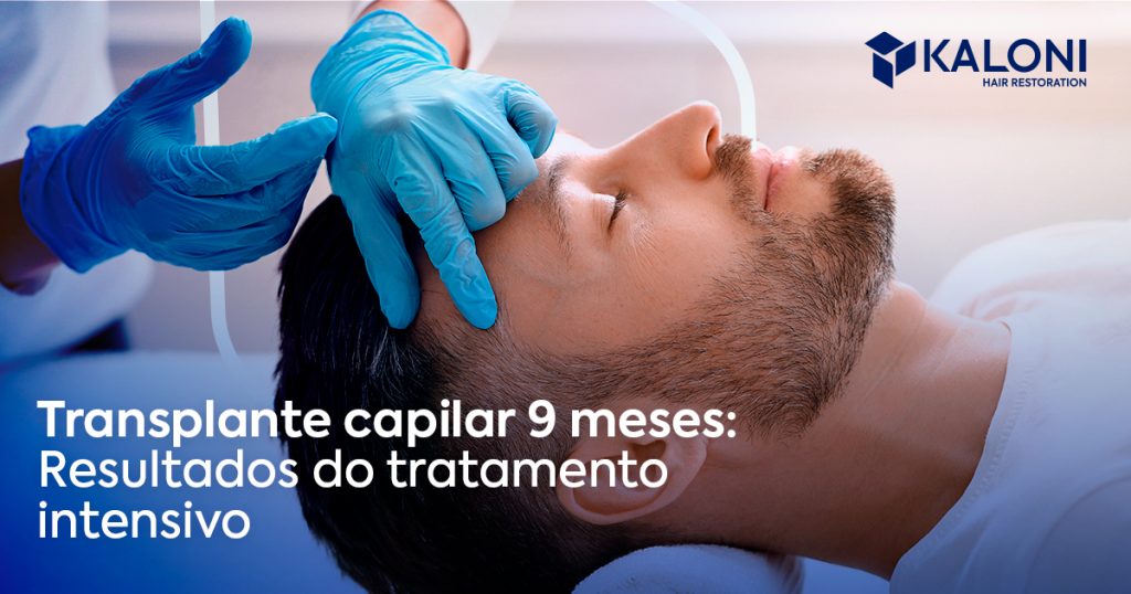 Transplante Capilar Meses Resultados Do Tratamento Intensivo Blog Kaloni